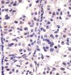CDK4 Antibody [Knockout Validated]